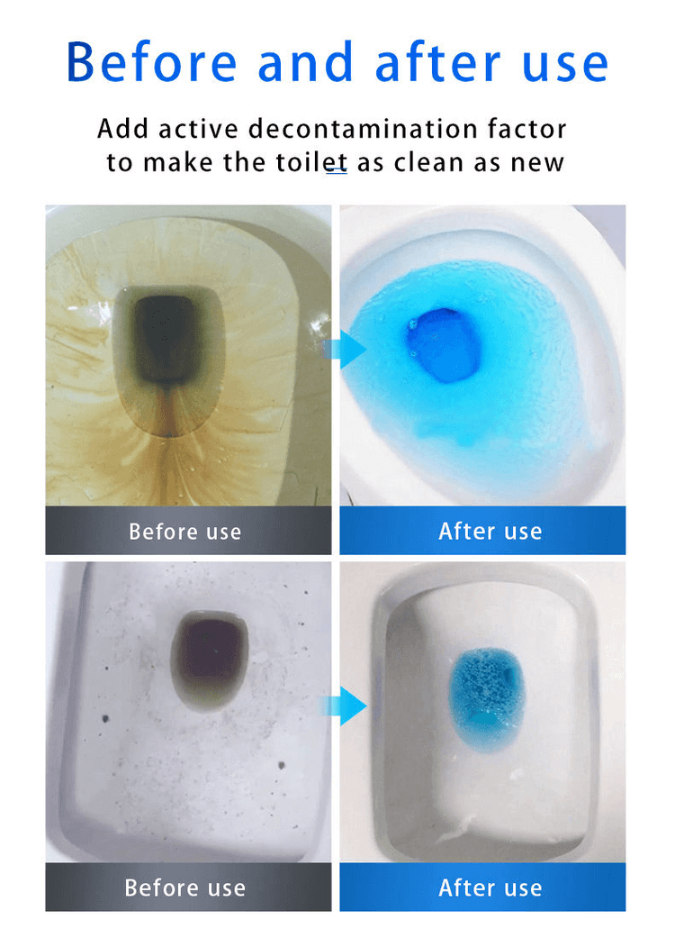 ⏰Last Day Surprise Price: Buy 2 Get 1 Free🔥SINK & DRAIN CLEANER